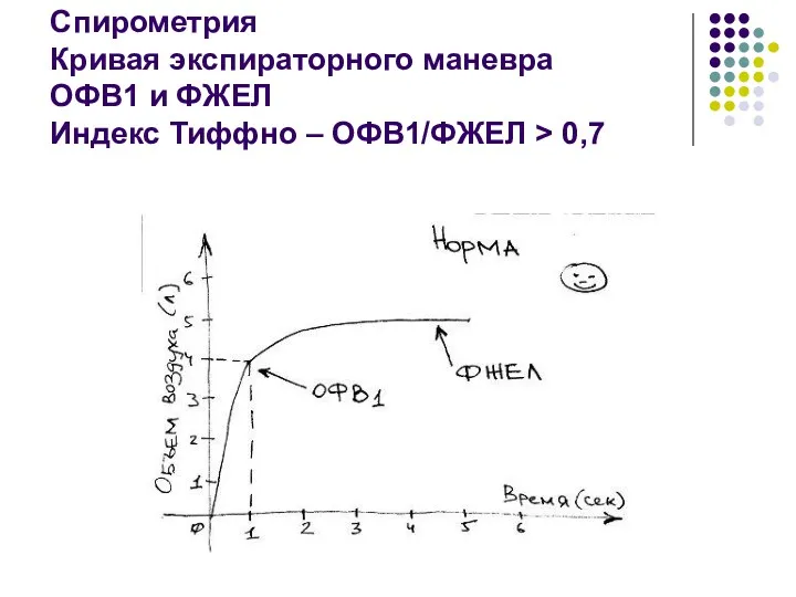 Спирометрия Кривая экспираторного маневра ОФВ1 и ФЖЕЛ Индекс Тиффно – ОФВ1/ФЖЕЛ > 0,7