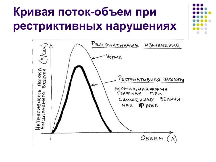 Кривая поток-объем при рестриктивных нарушениях