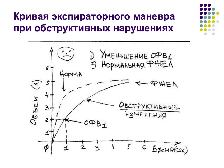 Кривая экспираторного маневра при обструктивных нарушениях