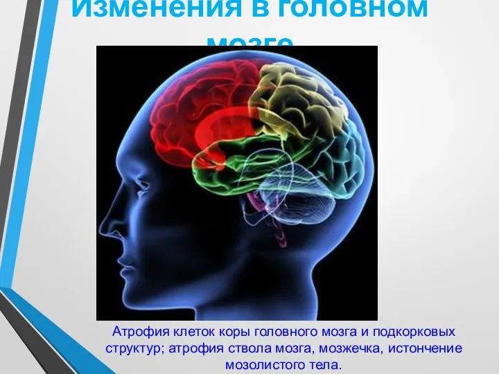 Изменения в головном мозге Атрофия клеток коры головного мозга и