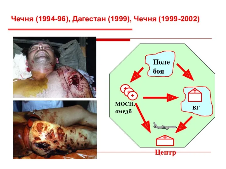 Чечня (1994-96), Дагестан (1999), Чечня (1999-2002) ВГ Поле боя МОСН, омедб Центр