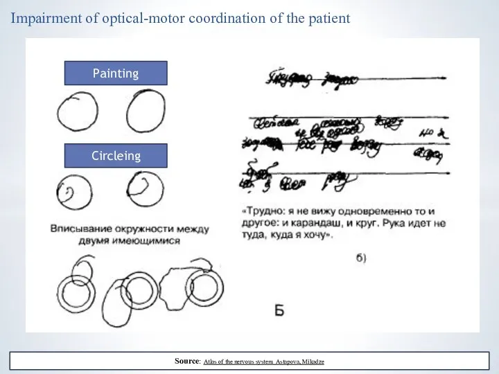Impairment of optical-motor coordination of the patient Source: Atlas of