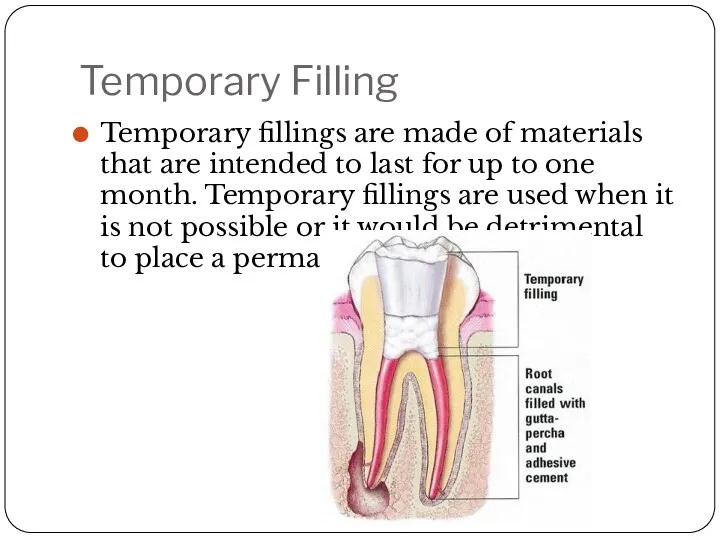 Temporary Filling Temporary fillings are made of materials that are