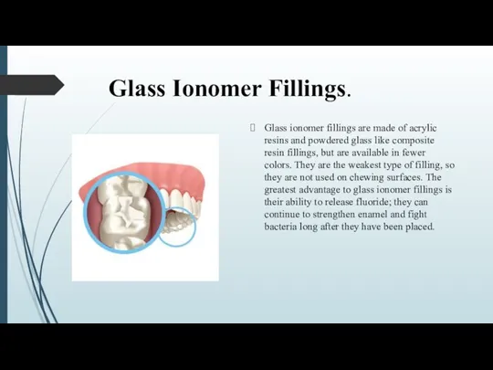 Glass Ionomer Fillings. Glass ionomer fillings are made of acrylic resins and powdered