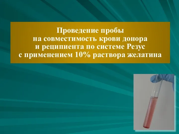 Проведение пробы на совместимость крови донора и реципиента по системе Резус с применением 10% раствора желатина