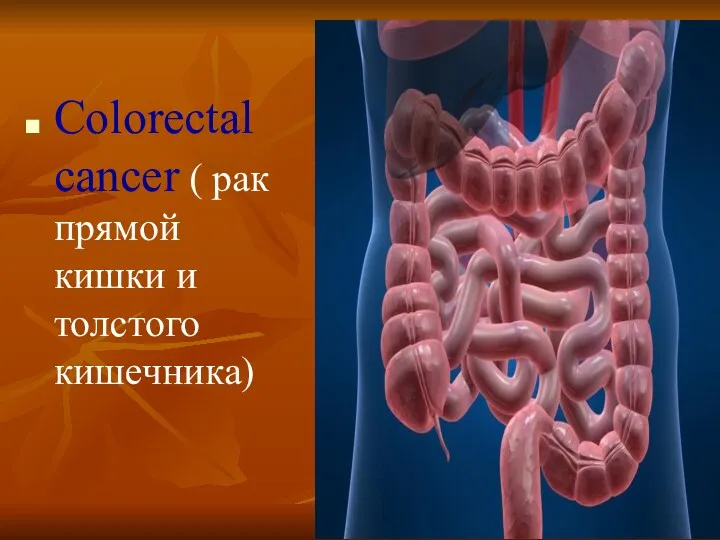 Colorectal cancer ( рак прямой кишки и толстого кишечника)