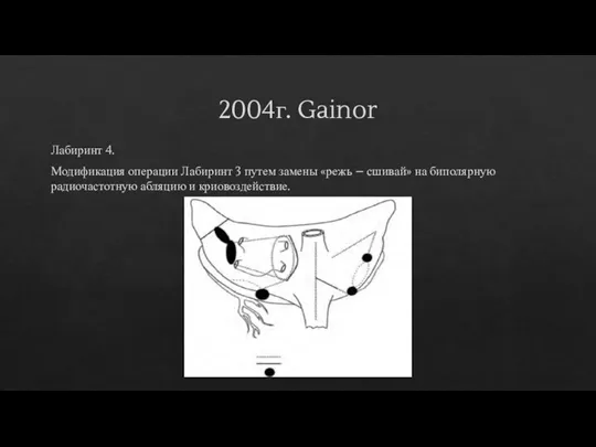 2004г. Gainor Лабиринт 4. Модификация операции Лабиринт 3 путем замены