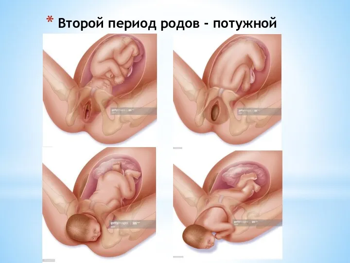 Второй период родов - потужной