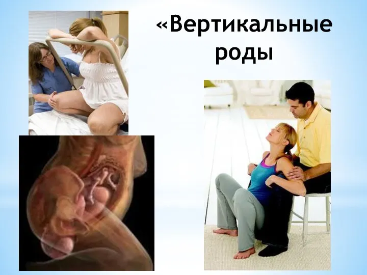 «Вертикальные роды