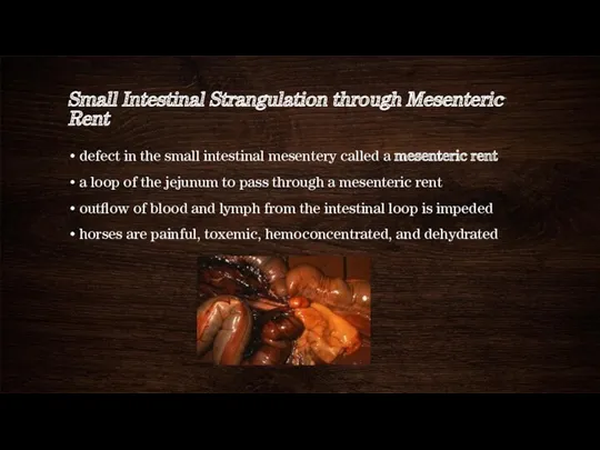 Small Intestinal Strangulation through Mesenteric Rent defect in the small intestinal mesentery called