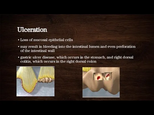 Ulceration Loss of mucosal epithelial cells may result in bleeding