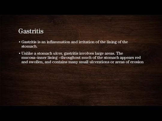 Gastritis Gastritis is an inflammation and irritation of the lining of the stomach.