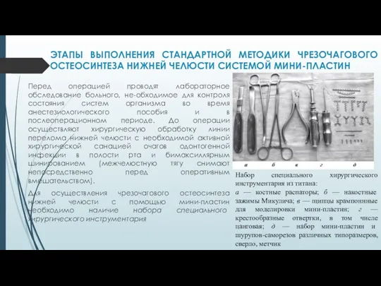 ЭТАПЫ ВЫПОЛНЕНИЯ СТАНДАРТНОЙ МЕТОДИКИ ЧРЕЗОЧАГОВОГО ОСТЕОСИНТЕЗА НИЖНЕЙ ЧЕЛЮСТИ СИСТЕМОЙ МИНИ-ПЛАСТИН