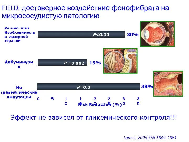 Risk Reduction (%) 0 5 10 15 20 25 30