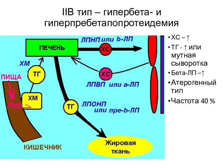 IIB тип – гипербета- и гиперпребетапопротеидемия ХС – ↑ ТГ