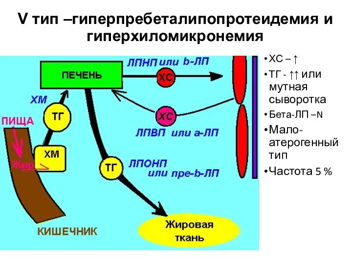 V тип –гиперпребеталипопротеидемия и гиперхиломикронемия ХС – ↑ ТГ -