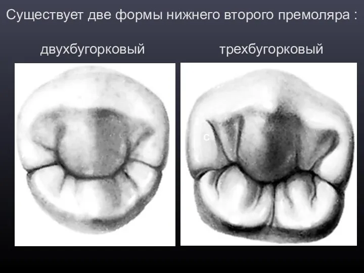 Существует две формы нижнего второго премоляра : двухбугорковый трехбугорковый