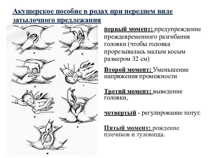 Акушерское пособие в родах при переднем виде затылочного предлежания первый