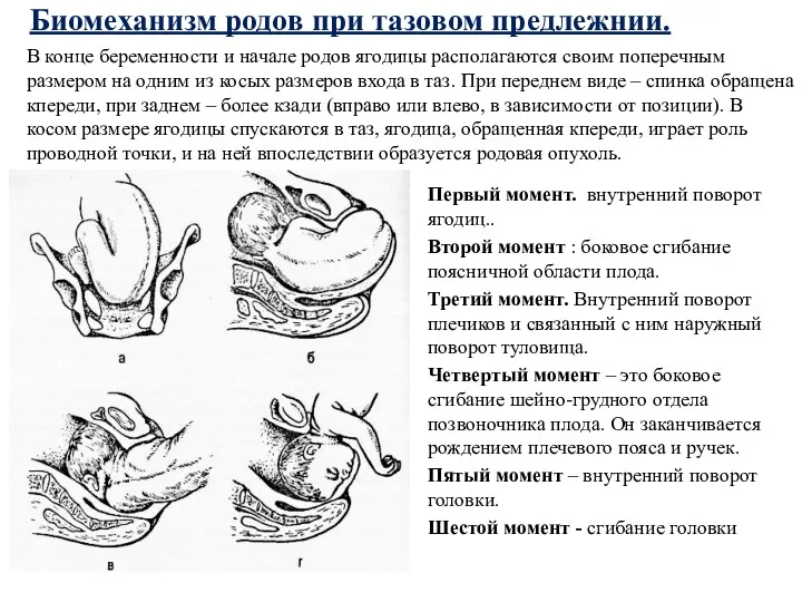 Биомеханизм родов при тазовом предлежнии. Первый момент. внутренний поворот ягодиц..