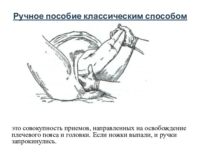 Ручное пособие классическим способом это совокупность приемов, направленных на освобождение