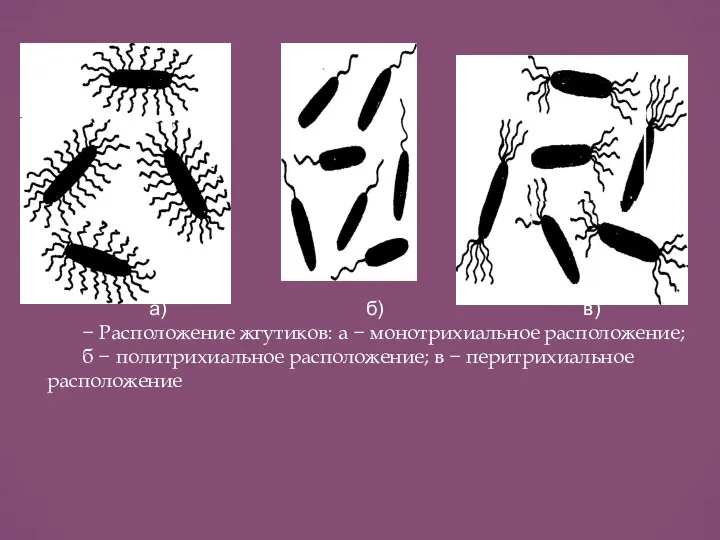 а) б) в) − Расположение жгутиков: а − монотрихиальное расположение;