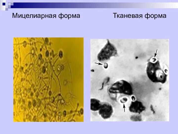 Мицелиарная форма Тканевая форма