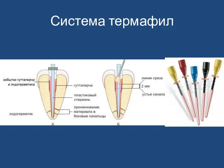 Система термафил