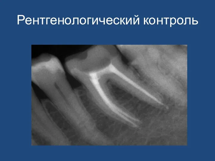 Рентгенологический контроль