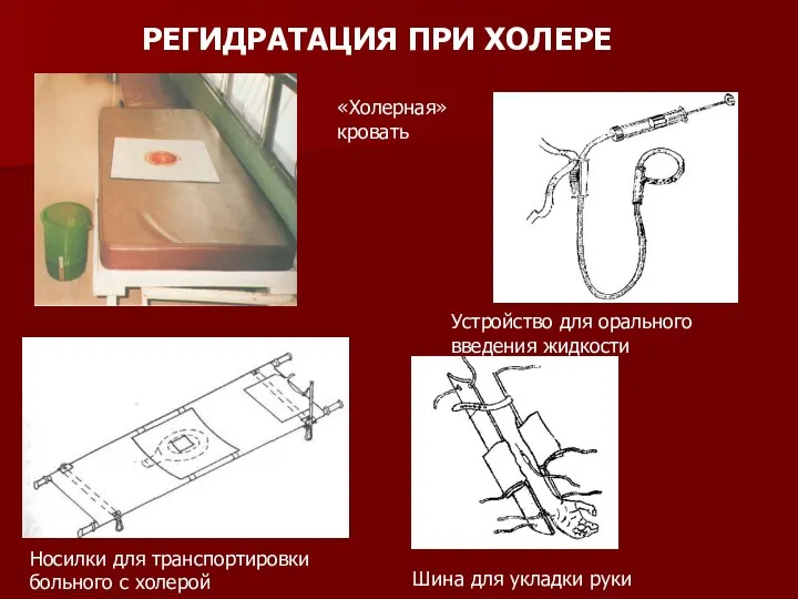 РЕГИДРАТАЦИЯ ПРИ ХОЛЕРЕ «Холерная» кровать Носилки для транспортировки больного с