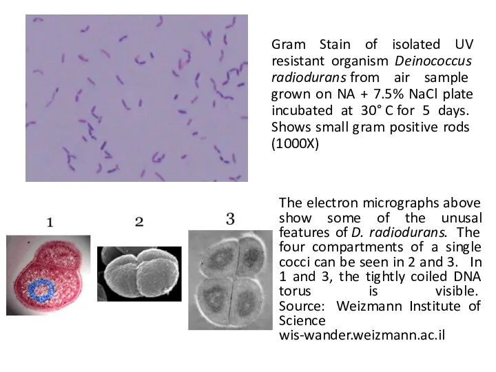 Gram Stain of isolated UV resistant organism Deinococcus radiodurans from