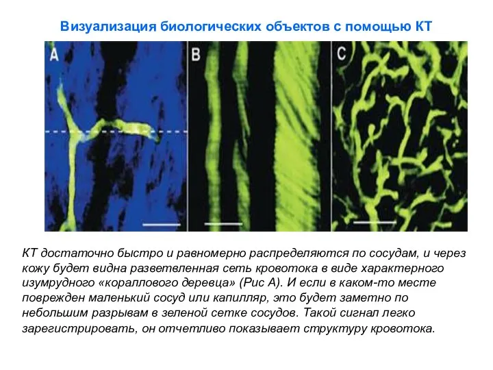 Визуализация биологических объектов с помощью КТ КТ достаточно быстро и