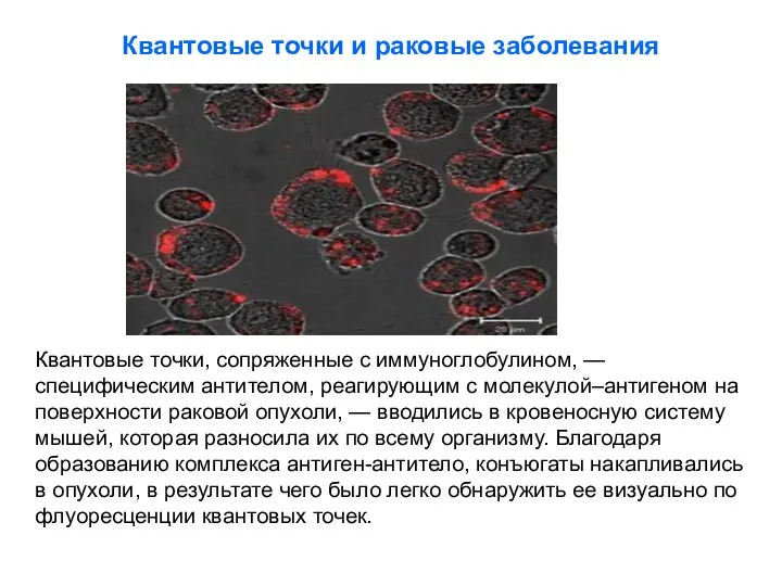 Квантовые точки и раковые заболевания Квантовые точки, сопряженные с иммуноглобулином, — специфическим антителом,