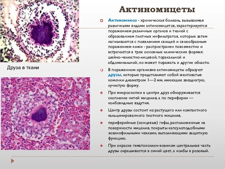 Актиномицеты Актиномикоз - хроническая болезнь, вызываемая различными видами актиномицетов, характеризуется