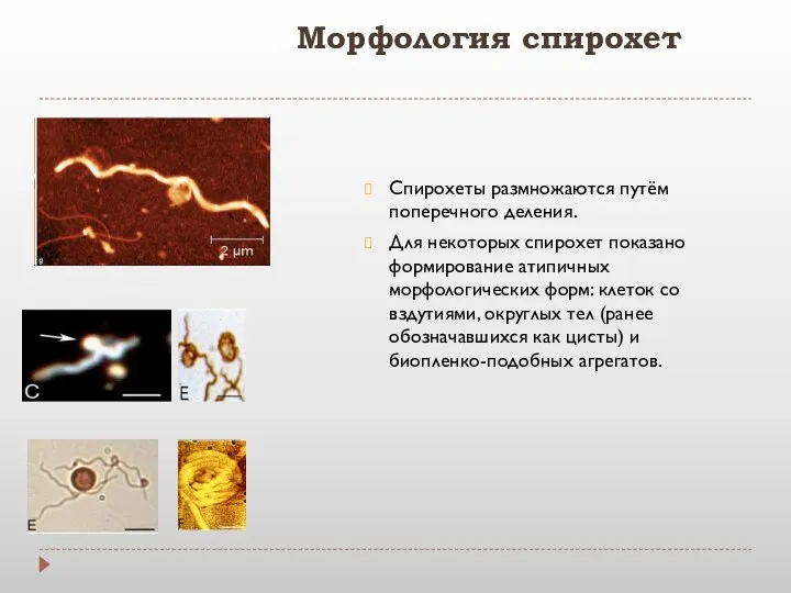 Морфология спирохет Спирохеты размножаются путём поперечного деления. Для некоторых спирохет