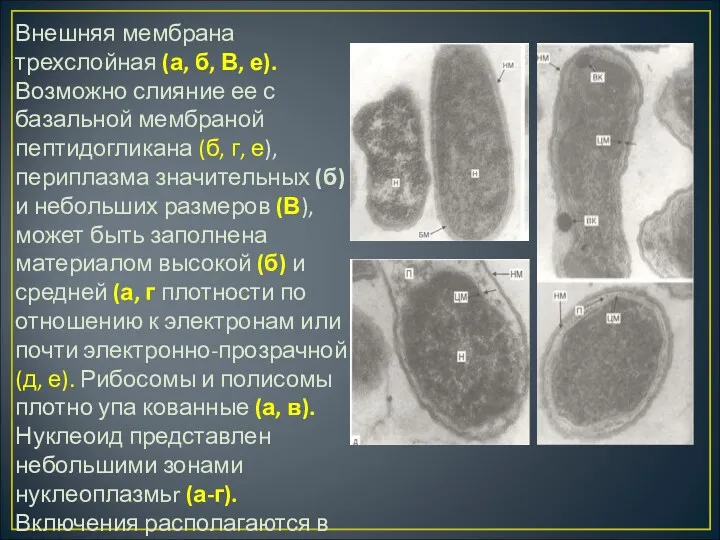 Внешняя мембрана трехслойная (а, б, В, е). Возможно слияние ее