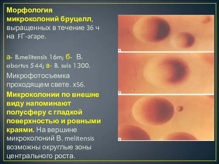 Морфология микроколоний бруцелл, выращенных в течение 36 ч на FГ-aгape.