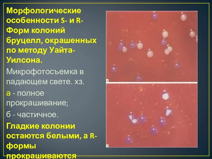 Морфологические особенности S- и R-Форм колоний бруцелл, окрашенных по методу