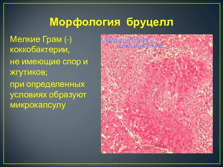 Морфология бруцелл Мелкие Грам (-) коккобактерии, не имеющие спор и жгутиков; при определенных условиях образуют микрокапсулу