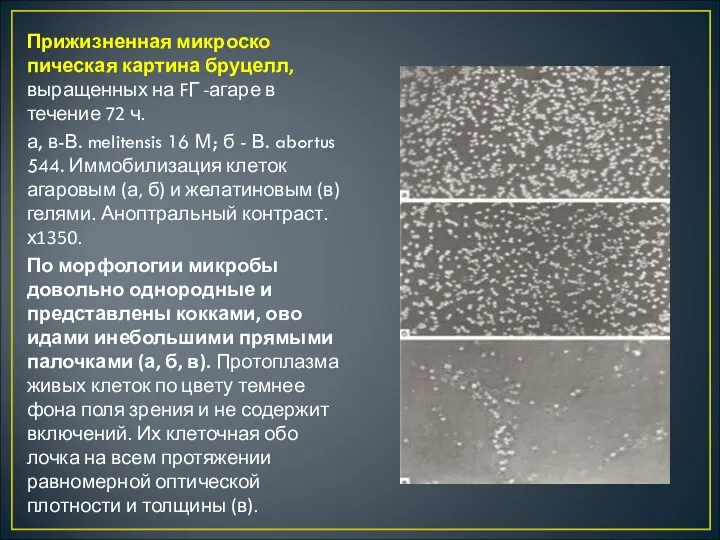 Прижизненная микроско­пическая картина бруцелл, выращен­ных на FГ -агаре в течение