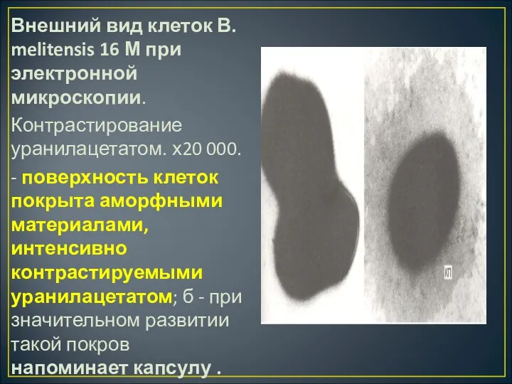 Внешний вид клеток В. melitensis 16 М при электронной микроскопии.