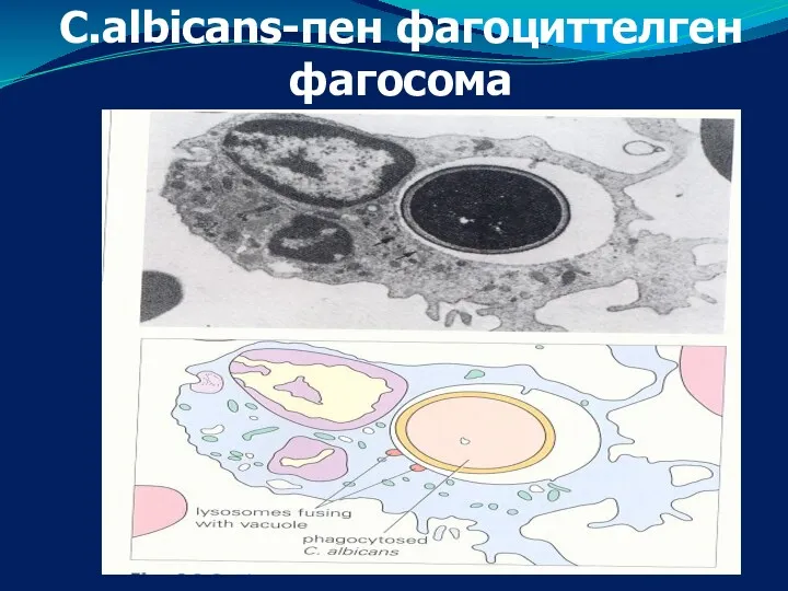 C.albicans-пен фагоциттелген фагосома