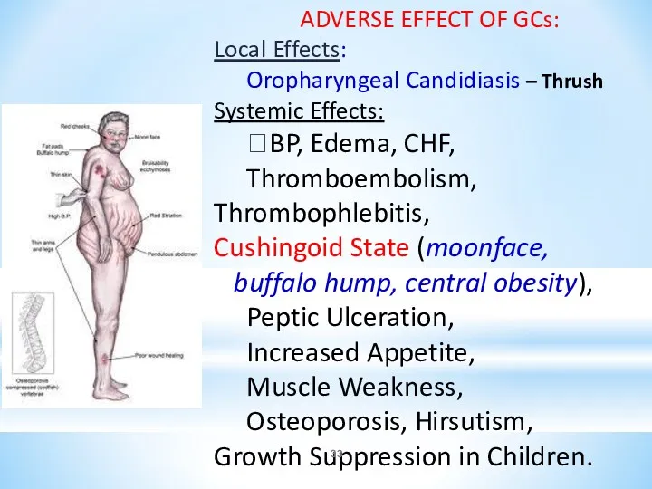 ADVERSE EFFECT OF GCs: Local Effects: Oropharyngeal Candidiasis – Thrush Systemic Effects: ?BP,