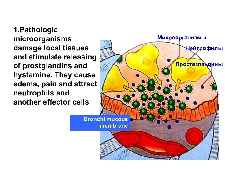 1.Pathologic microorganisms damage local tissues and stimulate releasing of prostglandins