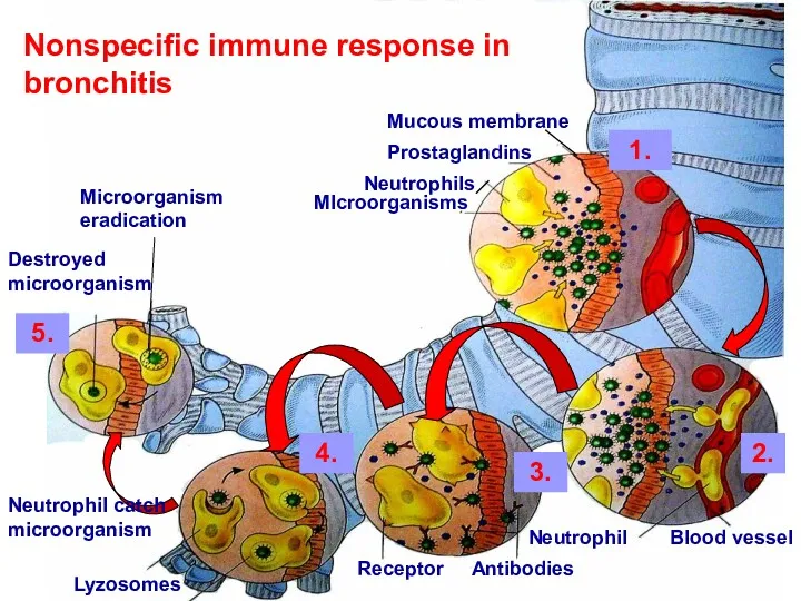 Mucous membrane Nonspecific immune response in bronchitis Prostaglandins Neutrophils MIcroorganisms