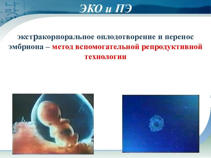 ЭКО и ПЭ экстракорпоральное оплодотворение и перенос эмбриона – метод вспомогательной репродуктивной технологии