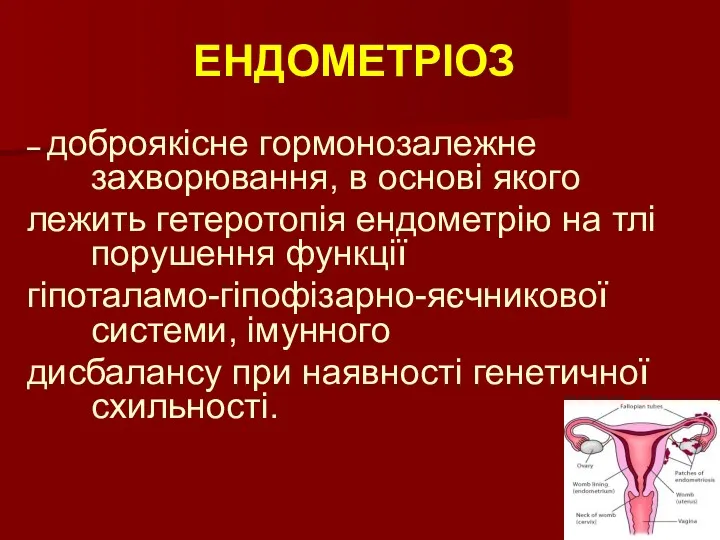 ЕНДОМЕТРІОЗ – доброякісне гормонозалежне захворювання, в основі якого лежить гетеротопія