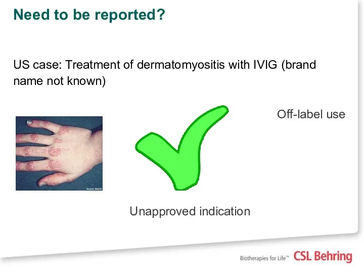 Need to be reported? US case: Treatment of dermatomyositis with