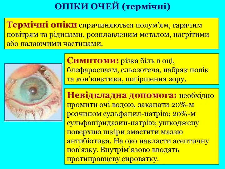 Термічні опіки спричиняються полум’ям, гарячим повітрям та рідинами, розплавленим металом,