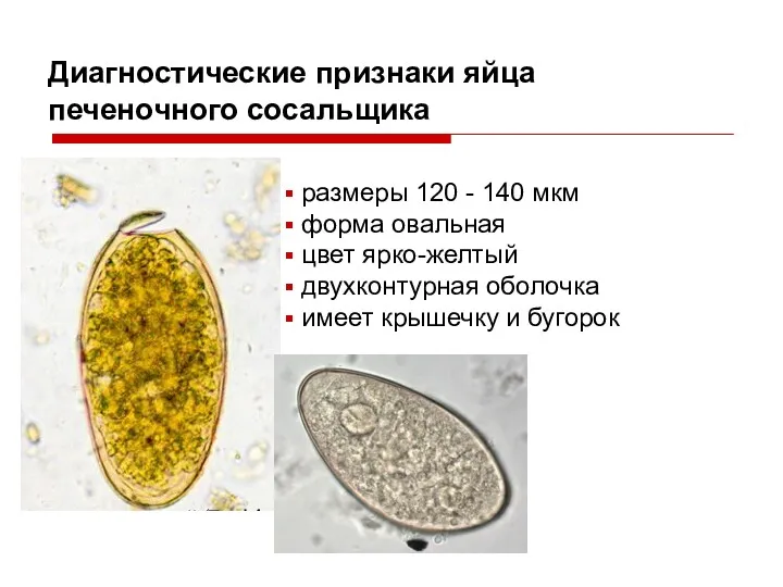 Диагностические признаки яйца печеночного сосальщика размеры 120 - 140 мкм