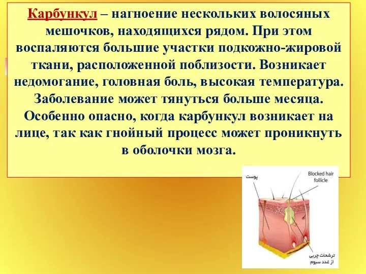 Карбункул – нагноение нескольких волосяных мешочков, находящихся рядом. При этом